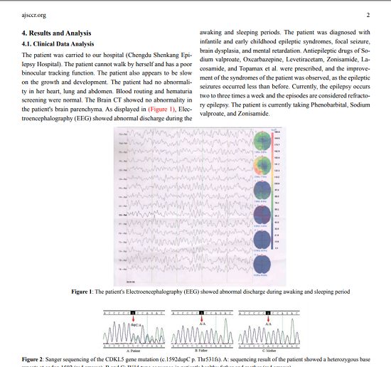 成都癲癇病醫(yī)院【學(xué)術(shù)動(dòng)態(tài)】：我院詹偉華院長(zhǎng)和豆曉峰主任癲癇病研究報(bào)告榮登國(guó)際醫(yī)學(xué)雜志